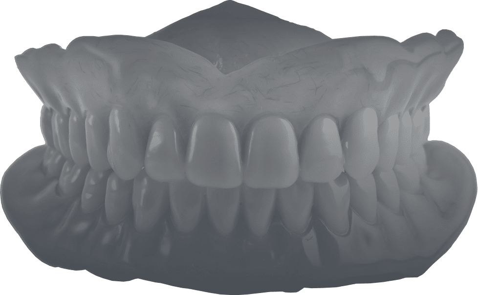 Complex smile - Implant centre