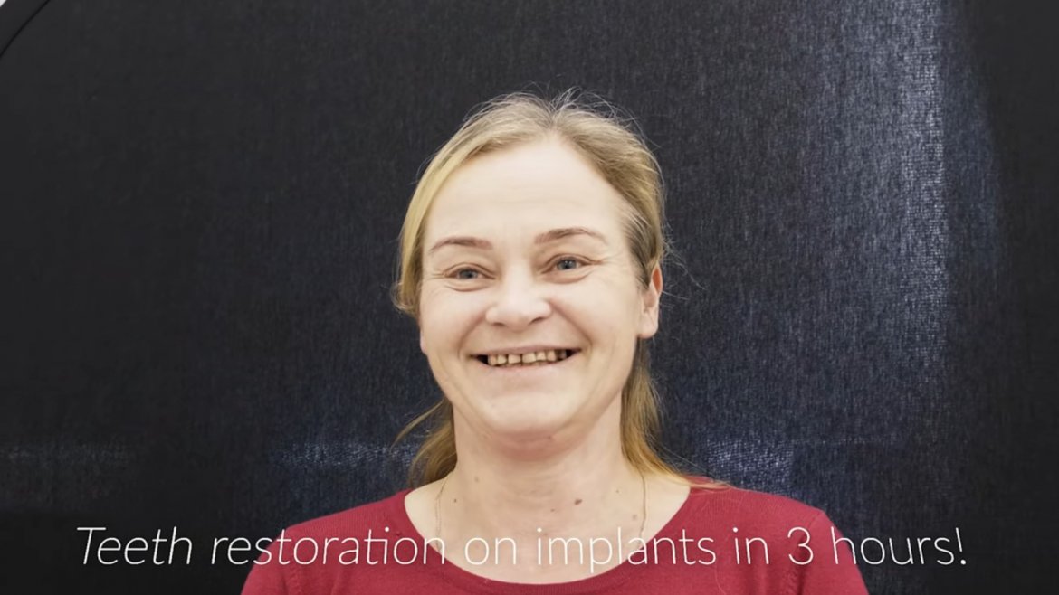 Teeth restoration on implants in only 3 hours